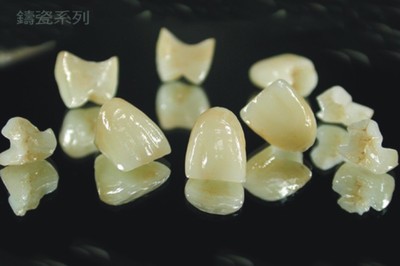 臺(tái)灣定遠(yuǎn)陶齒制品 工藝與美學(xué)的完美融合